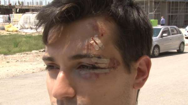 Bisikletiyle üniversiteye giden öğrenci sokak köpeklerinin saldırısına uğradı - Edirne haber