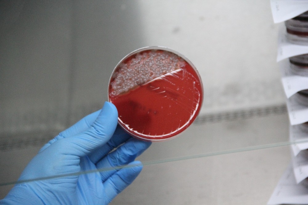 Uzun süre kullanılan maskedeki bakteriler laboratuvarda gözler önüne serildi
