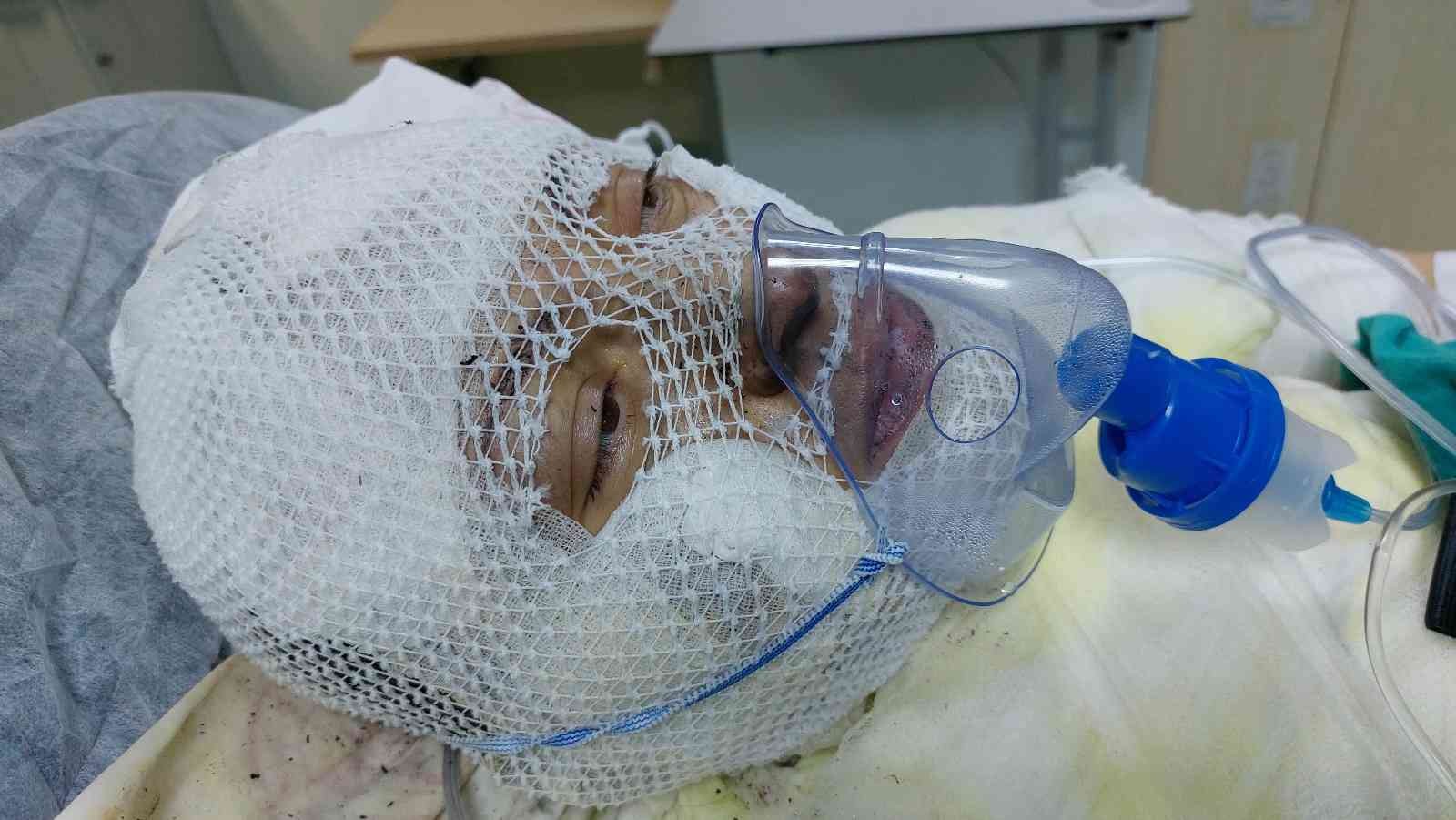 Boşandığı karısını yanıcı madde dökerek yaktı
