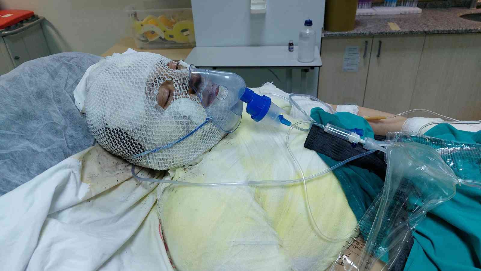 Boşandığı karısını yanıcı madde dökerek yaktı
