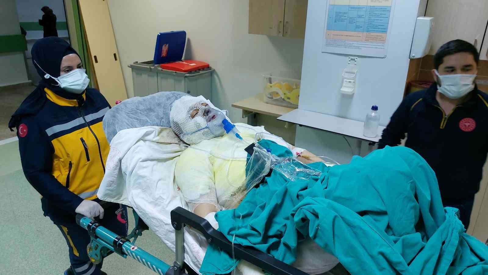 Boşandığı karısını yanıcı madde dökerek yaktı
