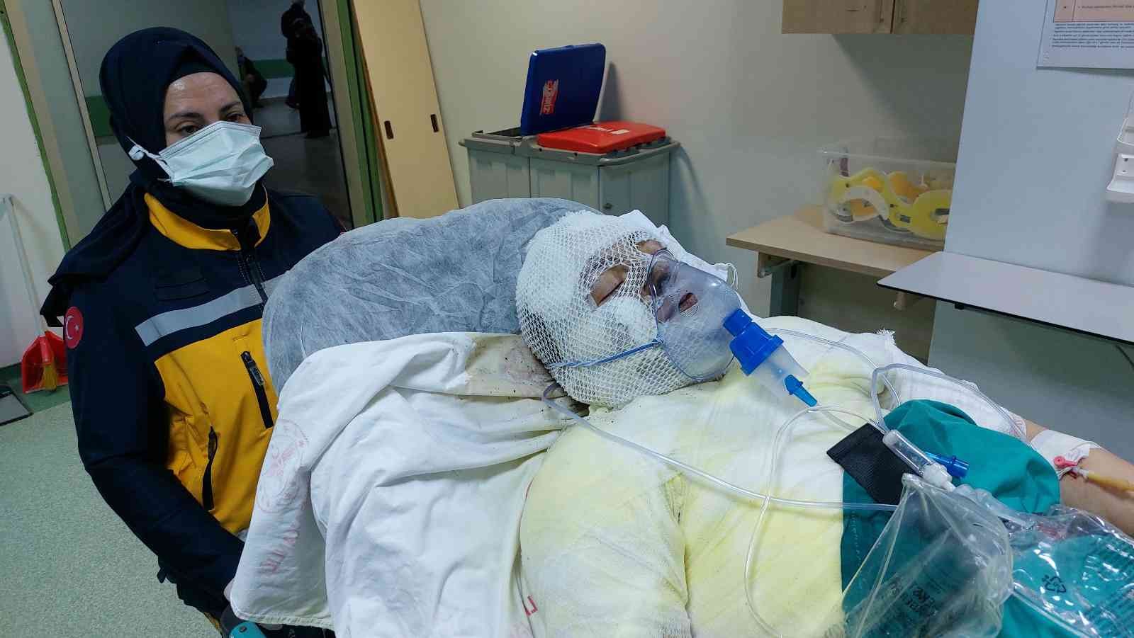 Boşandığı karısını yanıcı madde dökerek yaktı
