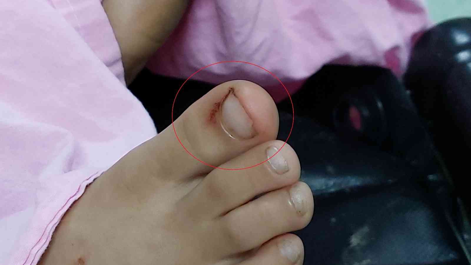 Ayak parmağını yılan sokan 7 yaşındaki çocuk hastanelik oldu
